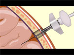 Medical Animation
